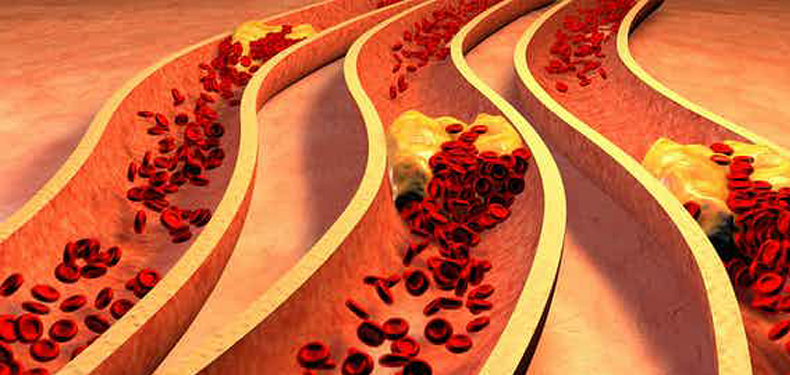 obesidad dana vasos sanguineos